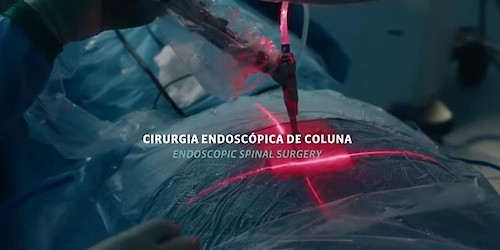 A cirurgia endoscópica à coluna é um procedimento inovador realizado no HPA Alvor