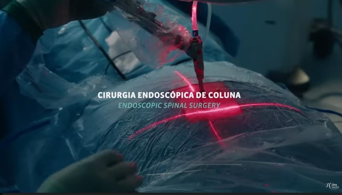 A cirurgia endoscópica à coluna é um procedimento inovador realizado no HPA Alvor