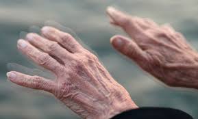 Travar a progressão da Doença de Parkinson está mais perto de ser uma realidade