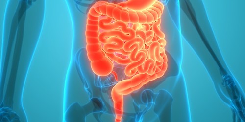 É preciso mais sensibilização e apoio para as pessoas com Síndrome do Intestino Curto