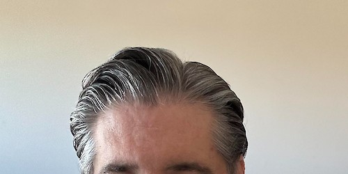 A relação entre a Diabetes e o Fígado: uma conexão crucial na saúde metabólica