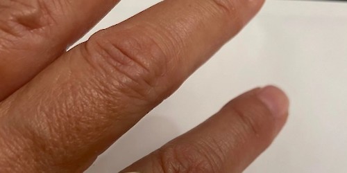 As funções dos anéis de brasão ao longo da História