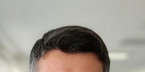 Doença coronária: prevenir, acompanhar e tratar atempadamente