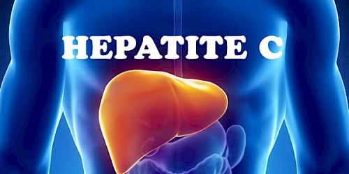 É preciso fazer mais e melhor se quisermos erradicar a hepatite C até 2030