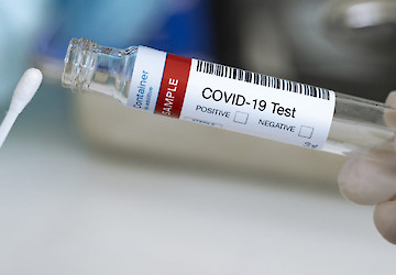 Hospital Particular do Algarve: Alvor realiza testes à COVID em sistema "Drive-thru"