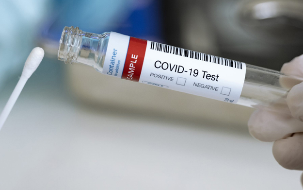 Hospital Particular do Algarve: Alvor realiza testes à COVID em sistema "Drive-thru"