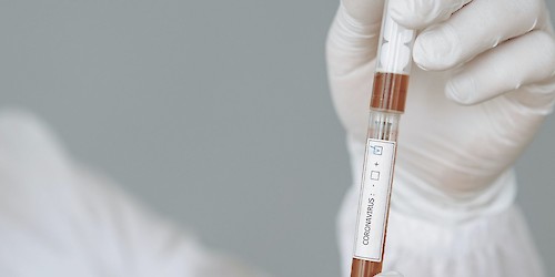 Covid-19: Associações de doentes lançam petição pelo acesso generalizado aos testes rápidos de antigénio