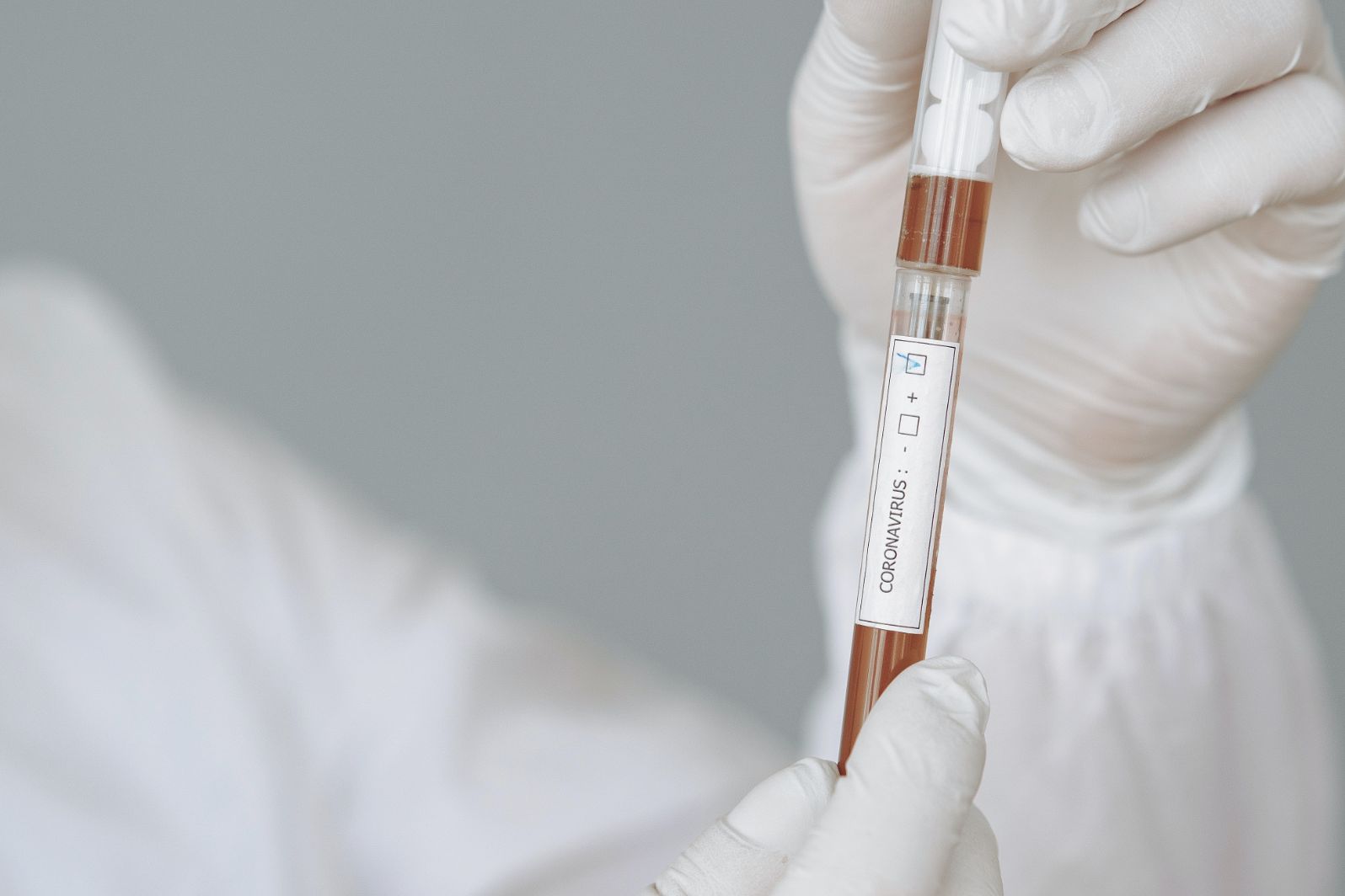 Covid-19: Associações de doentes lançam petição pelo acesso generalizado aos testes rápidos de antigénio