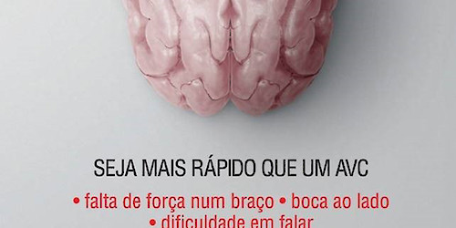 É essencial assegurar o tratamento adequado e uma vida após AVC integrada e com qualidade