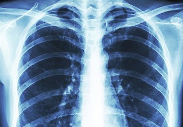 Doenças respiratórias não COVID-19 matam 36 pessoas por dia em Portugal